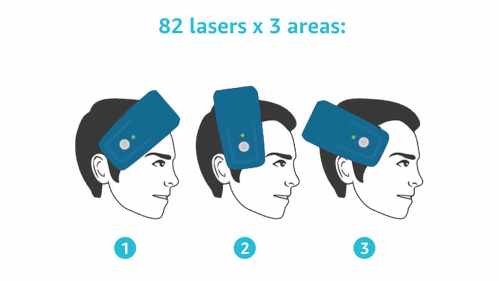 how to use laserband 82 for hair growth