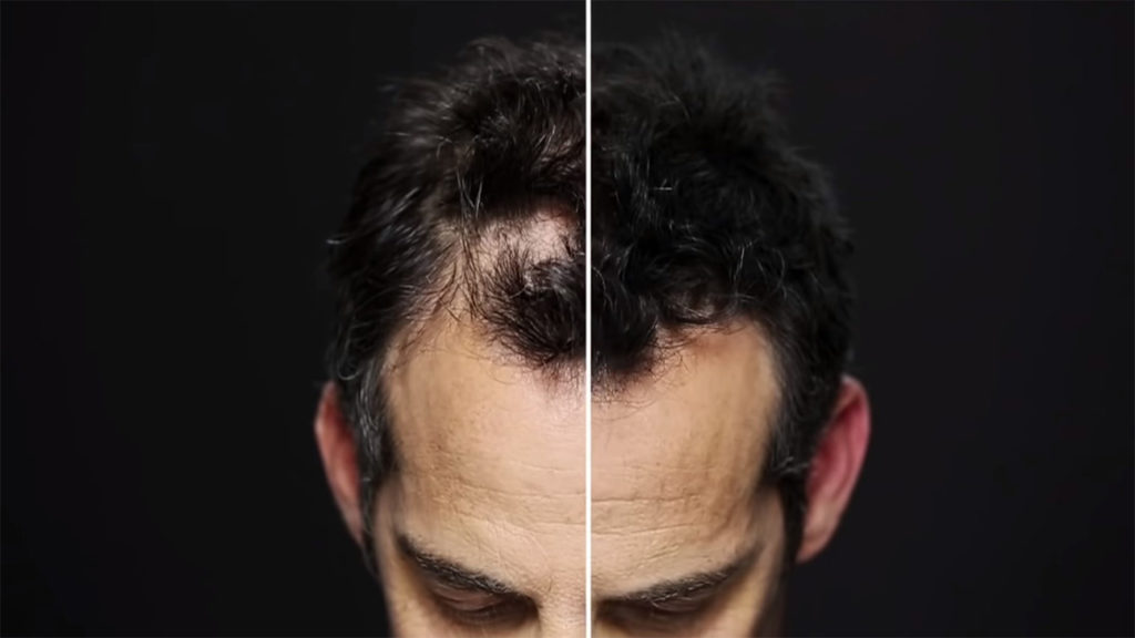 hair fibers before after on man head