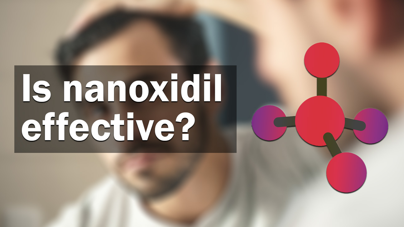 is nanoxidil effective?