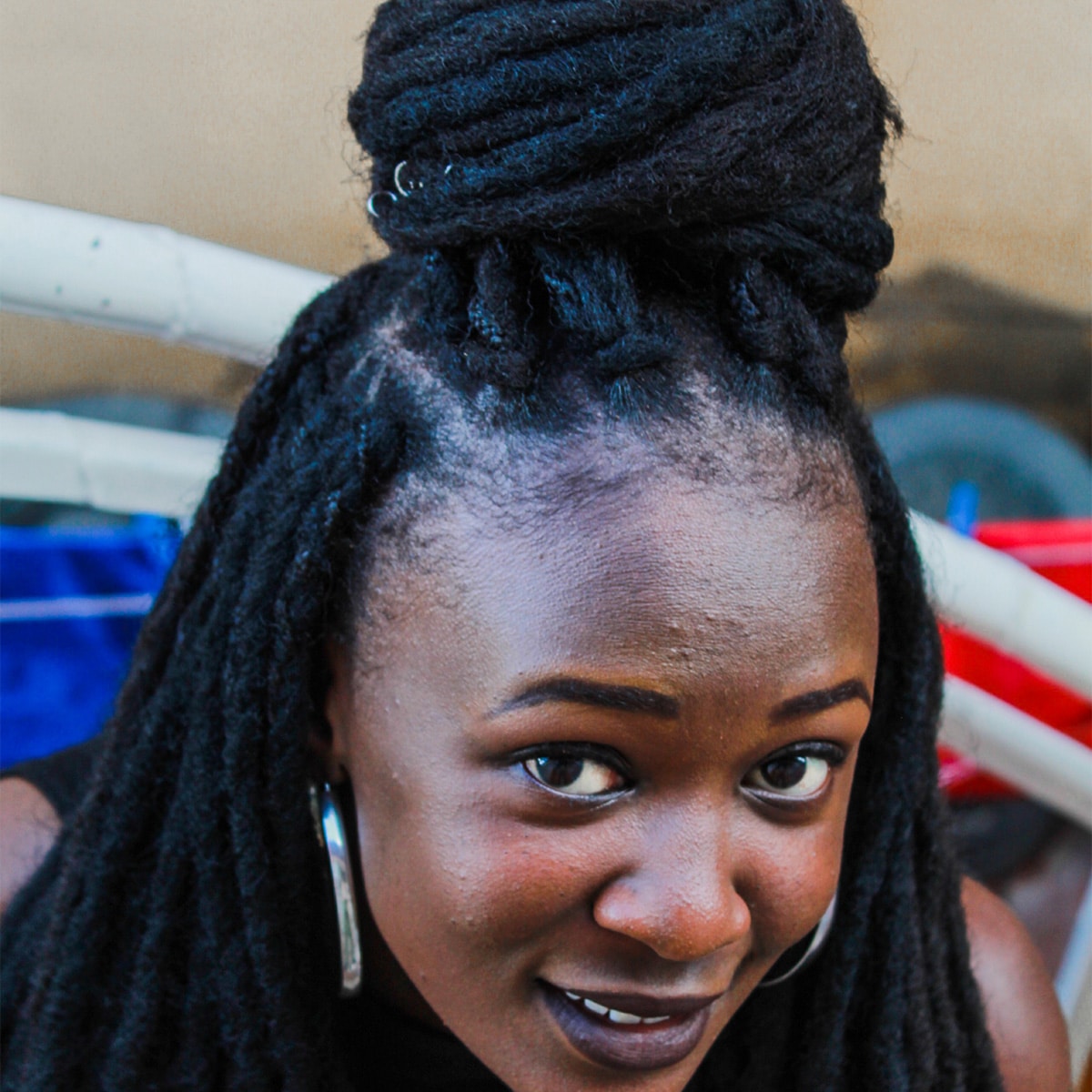Why Do So Many Black Women Have Alopecia? - Word In Black