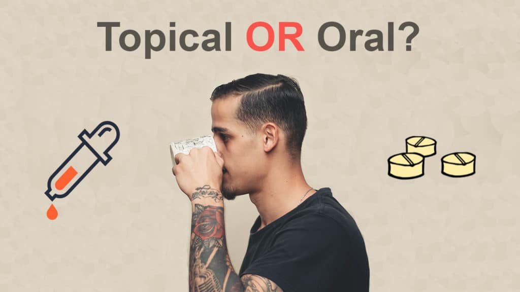topical finasteride vs oral