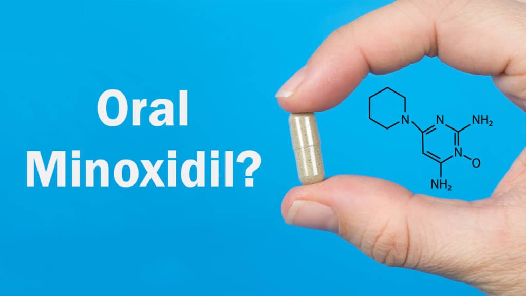 oral minoxidil for hair loss